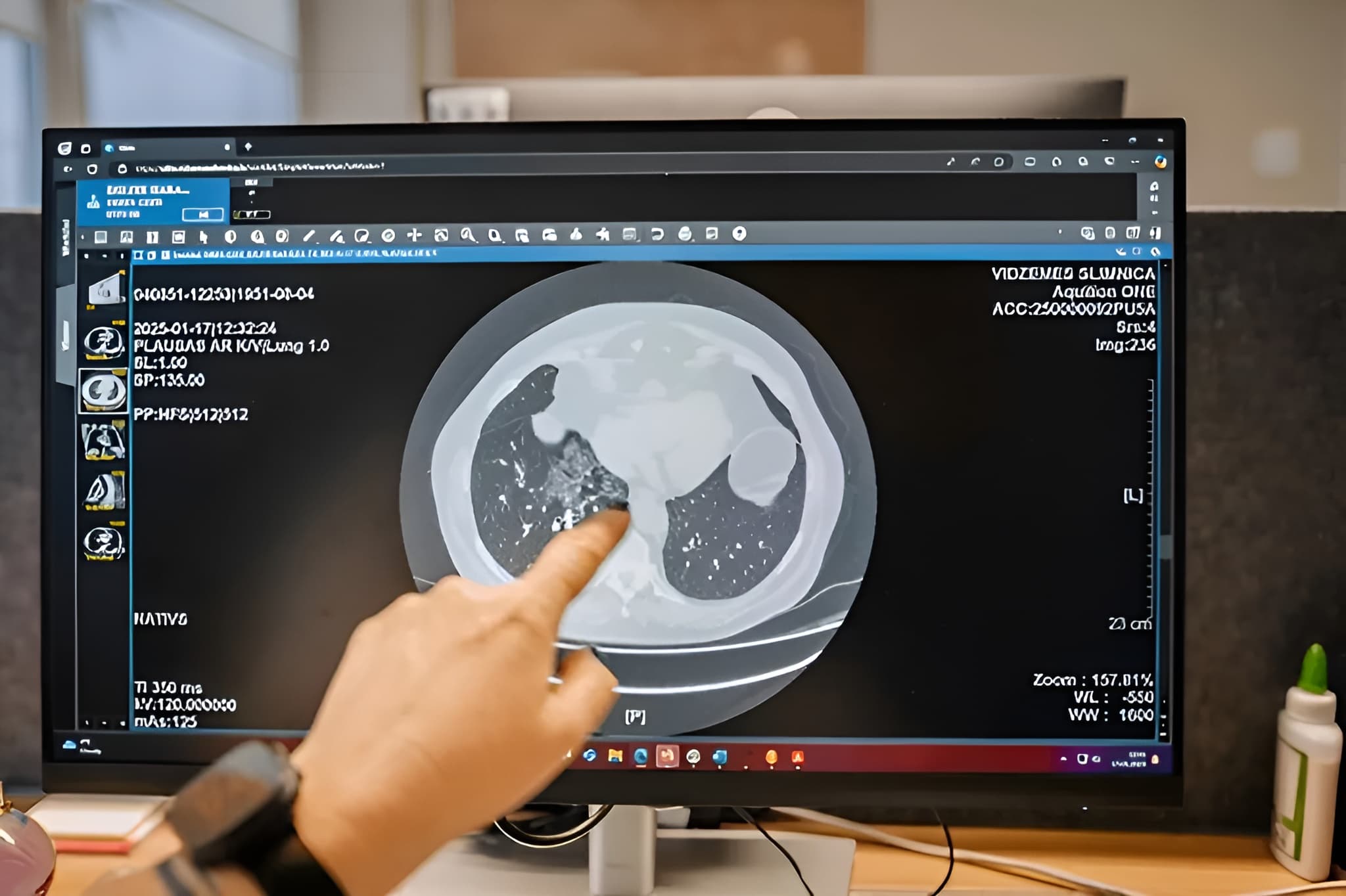 Radiology Information System Platform